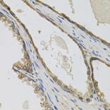 Immunohistochemistry - Anti-CCK4 Antibody (A16348) - Antibodies.com