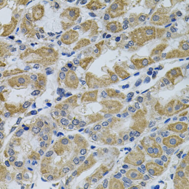 Immunohistochemistry - Anti-CCK4 Antibody (A16348) - Antibodies.com