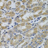 Immunohistochemistry - Anti-CCK4 Antibody (A16348) - Antibodies.com