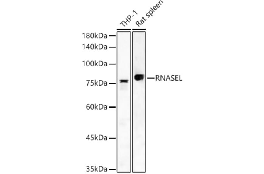 Western Blot - Anti-RNase L Antibody (A16349) - Antibodies.com