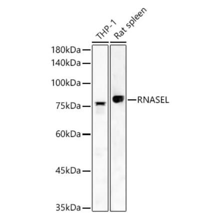 Western Blot - Anti-RNase L Antibody (A16349) - Antibodies.com