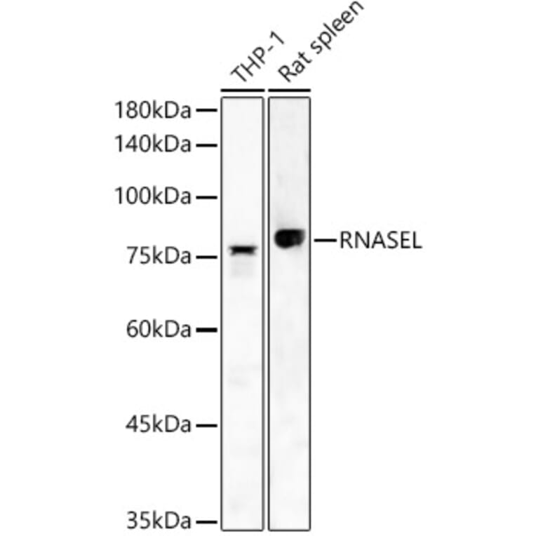 Western Blot - Anti-RNase L Antibody (A16349) - Antibodies.com