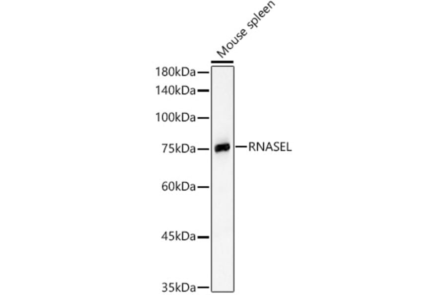 Western Blot - Anti-RNase L Antibody (A16349) - Antibodies.com