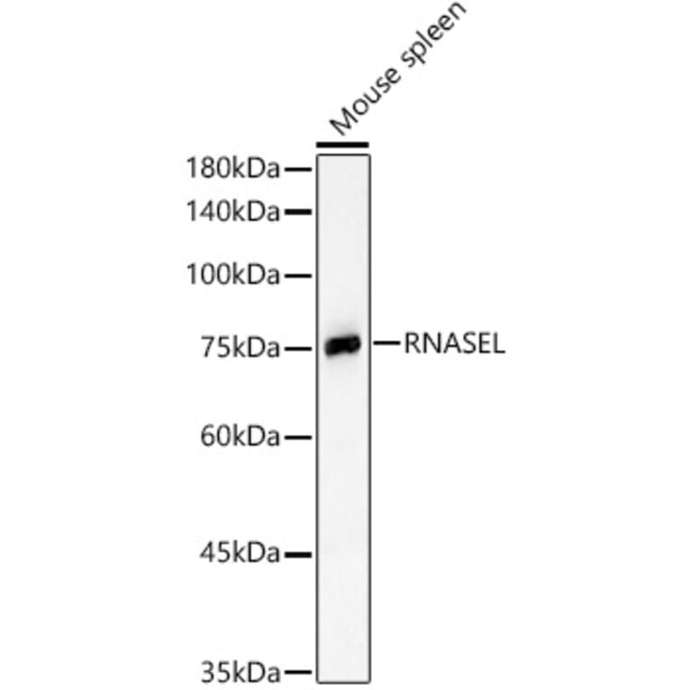 Western Blot - Anti-RNase L Antibody (A16349) - Antibodies.com