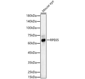 Western Blot - Anti-RPE65 Antibody (A16350) - Antibodies.com