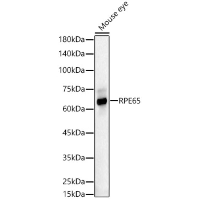 Western Blot - Anti-RPE65 Antibody (A16350) - Antibodies.com