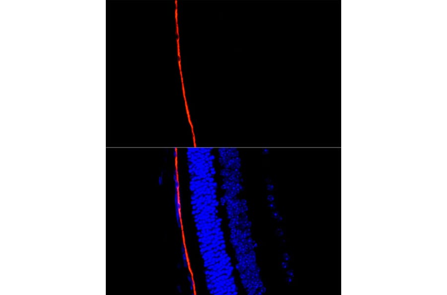 Immunofluorescence - Anti-RPE65 Antibody (A16350) - Antibodies.com