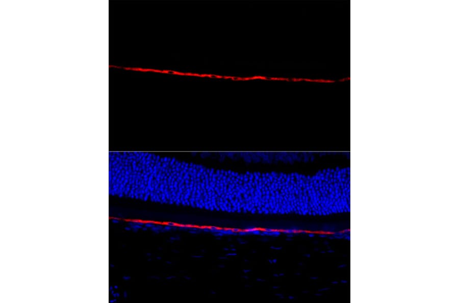 Immunofluorescence - Anti-RPE65 Antibody (A16350) - Antibodies.com