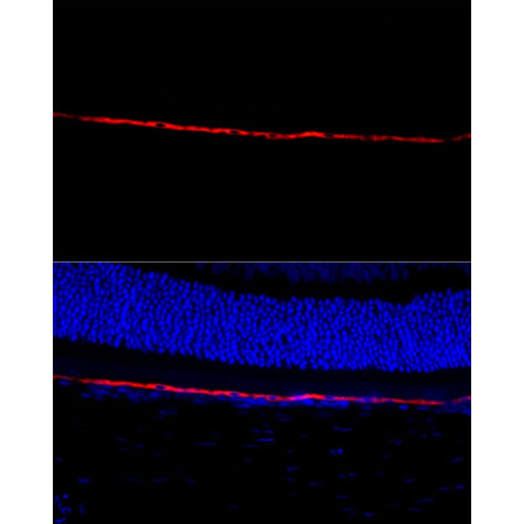 Immunofluorescence - Anti-RPE65 Antibody (A16350) - Antibodies.com