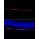 Immunofluorescence - Anti-RPE65 Antibody (A16350) - Antibodies.com