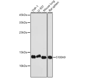Western Blot - Anti-S100A9 Antibody (A16351) - Antibodies.com