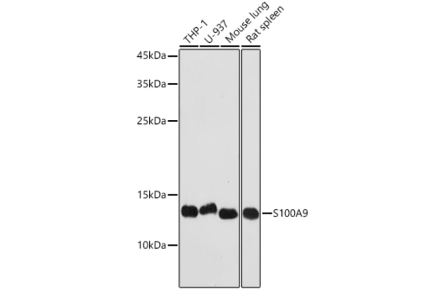 Western Blot - Anti-S100A9 Antibody (A16351) - Antibodies.com