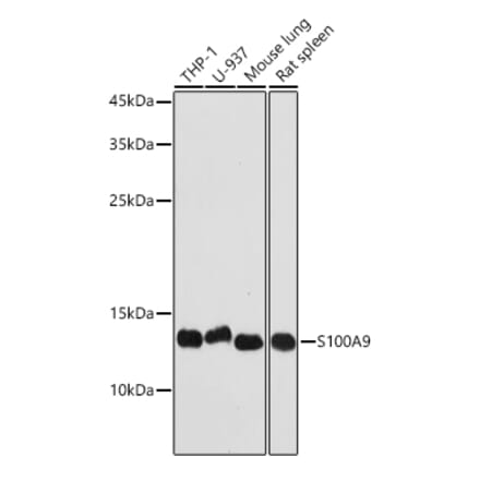 Western Blot - Anti-S100A9 Antibody (A16351) - Antibodies.com