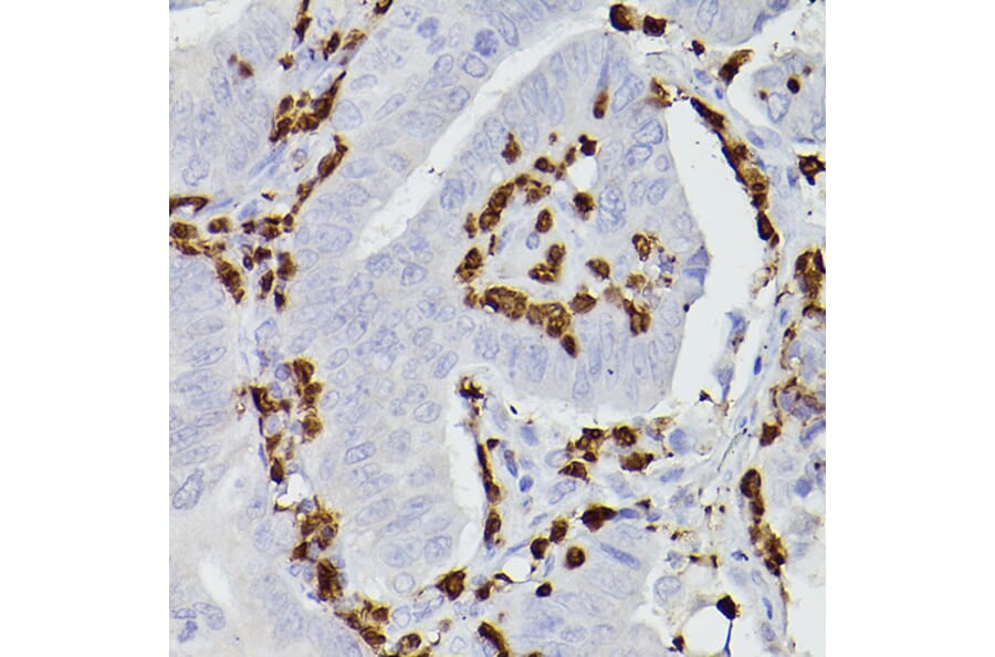 Immunohistochemistry - Anti-S100A9 Antibody (A16351) - Antibodies.com