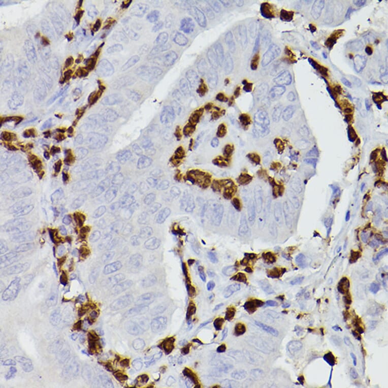 Immunohistochemistry - Anti-S100A9 Antibody (A16351) - Antibodies.com