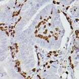 Immunohistochemistry - Anti-S100A9 Antibody (A16351) - Antibodies.com