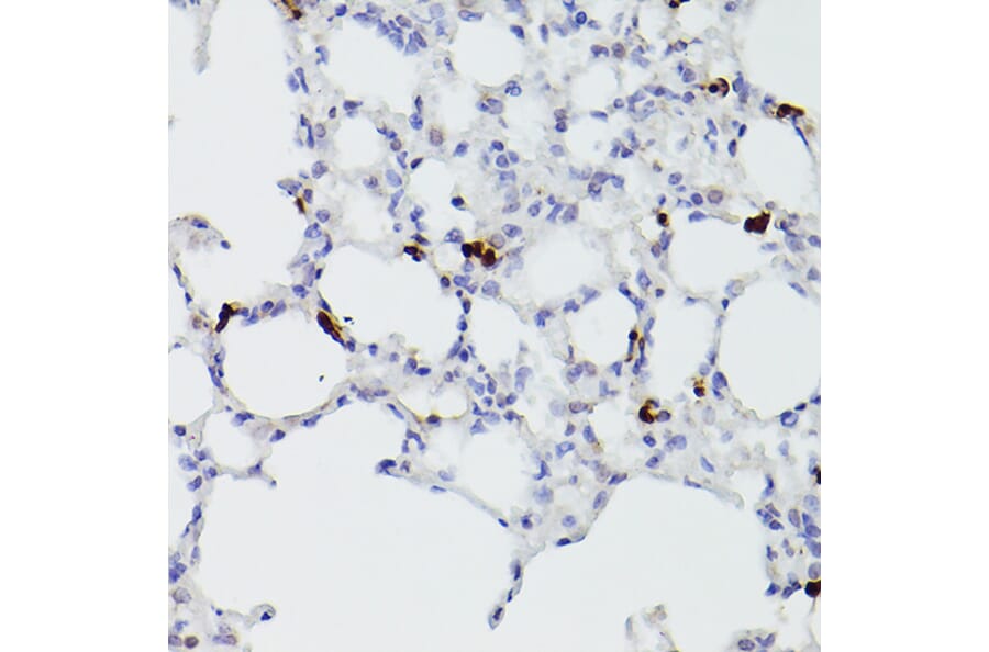Immunohistochemistry - Anti-S100A9 Antibody (A16351) - Antibodies.com