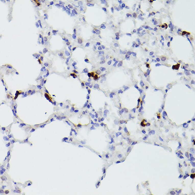 Immunohistochemistry - Anti-S100A9 Antibody (A16351) - Antibodies.com