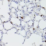 Immunohistochemistry - Anti-S100A9 Antibody (A16351) - Antibodies.com
