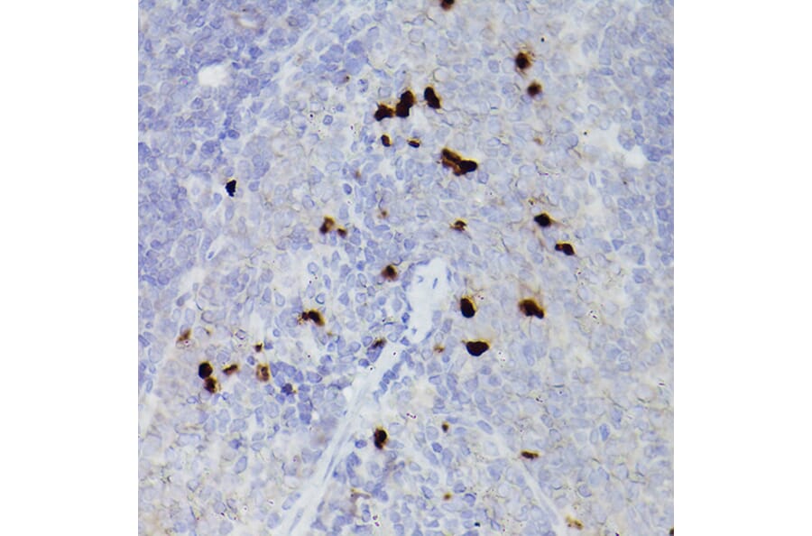 Immunohistochemistry - Anti-S100A9 Antibody (A16351) - Antibodies.com