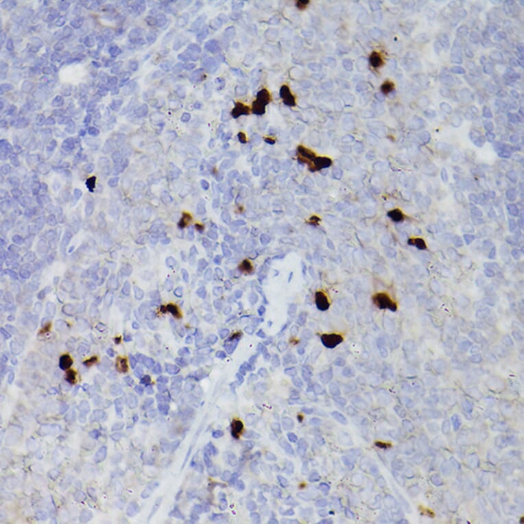 Immunohistochemistry - Anti-S100A9 Antibody (A16351) - Antibodies.com