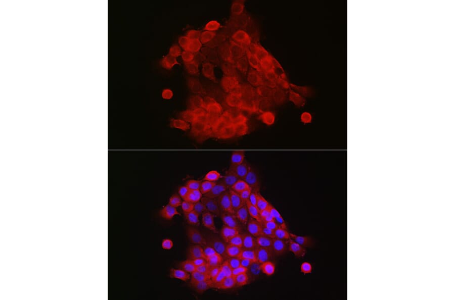 Immunofluorescence - Anti-S100A9 Antibody (A16351) - Antibodies.com