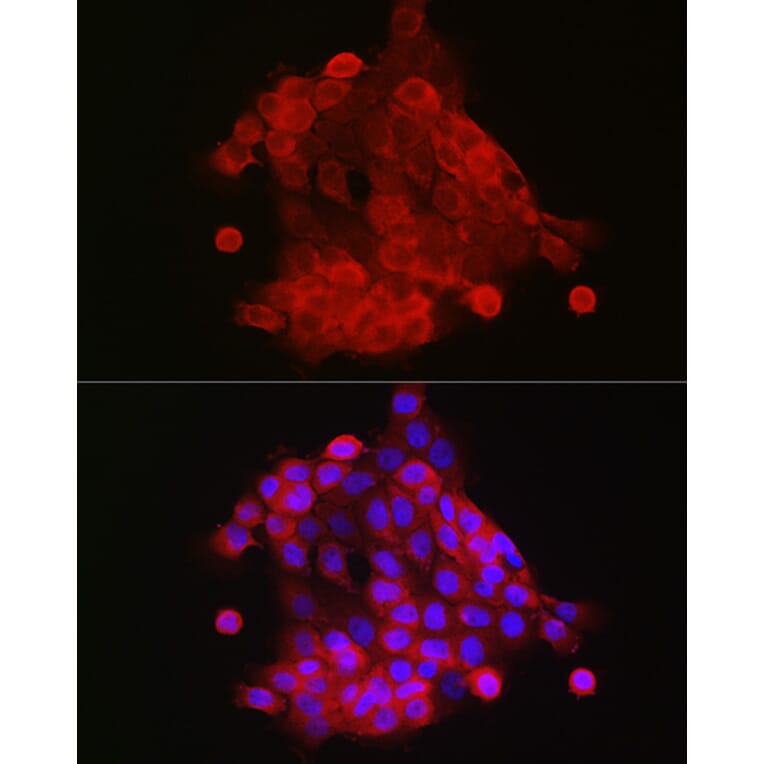 Immunofluorescence - Anti-S100A9 Antibody (A16351) - Antibodies.com
