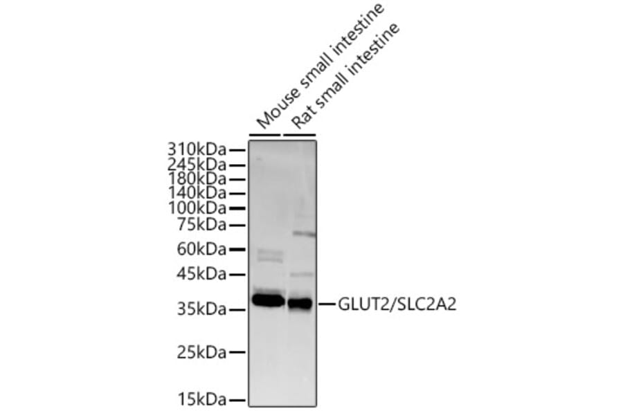 Western Blot - Anti-Glucose Transporter GLUT2 Antibody (A16352) - Antibodies.com