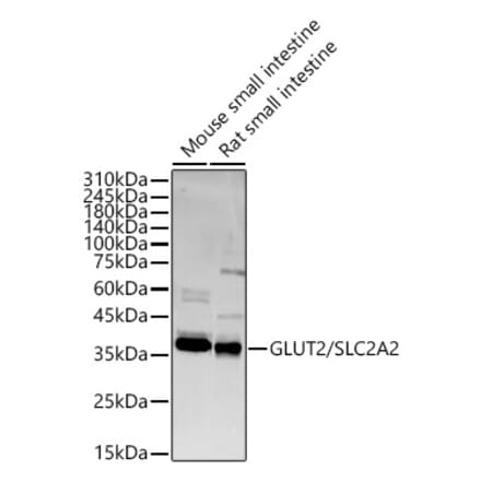 Western Blot - Anti-Glucose Transporter GLUT2 Antibody (A16352) - Antibodies.com
