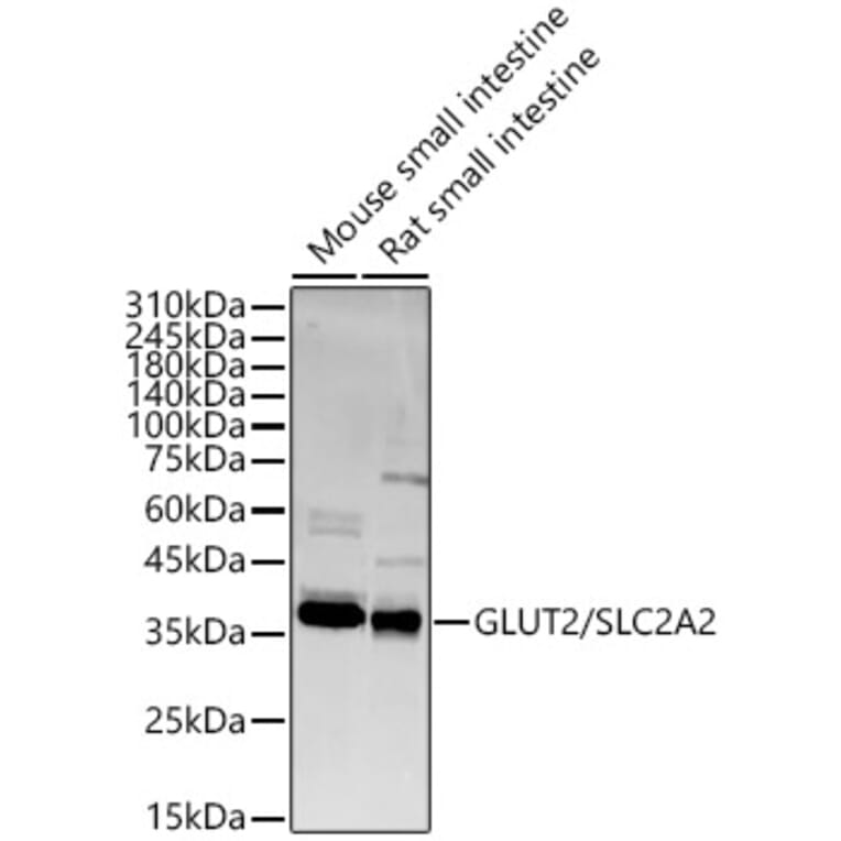 Western Blot - Anti-Glucose Transporter GLUT2 Antibody (A16352) - Antibodies.com