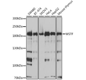 Western Blot - Anti-WSTF Antibody (A16353) - Antibodies.com