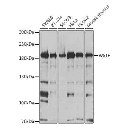 Western Blot - Anti-WSTF Antibody (A16353) - Antibodies.com