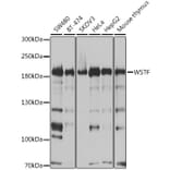 Western Blot - Anti-WSTF Antibody (A16353) - Antibodies.com