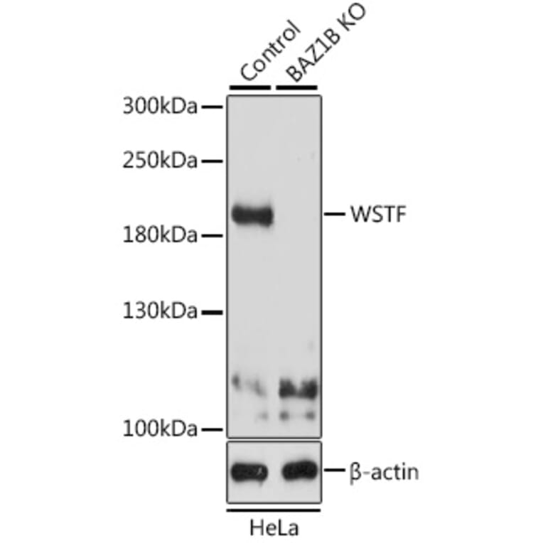 Western Blot - Anti-WSTF Antibody (A16353) - Antibodies.com