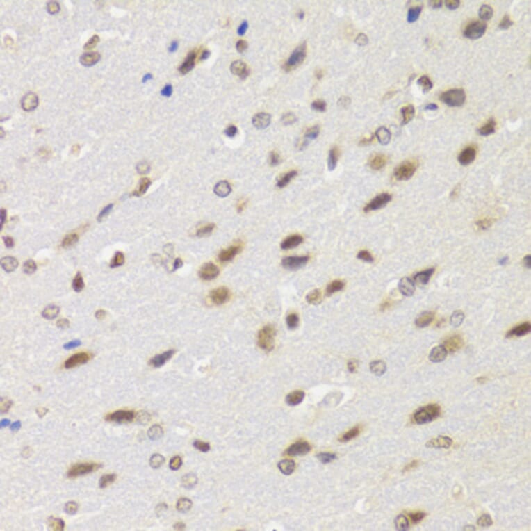 Immunohistochemistry - Anti-WSTF Antibody (A16353) - Antibodies.com
