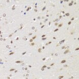 Immunohistochemistry - Anti-WSTF Antibody (A16353) - Antibodies.com