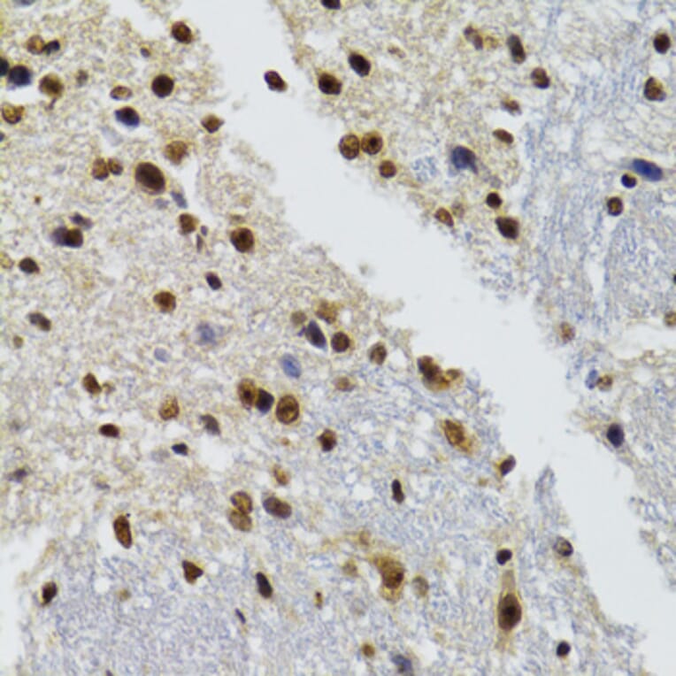 Immunohistochemistry - Anti-WSTF Antibody (A16353) - Antibodies.com