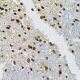 Immunohistochemistry - Anti-WSTF Antibody (A16353) - Antibodies.com