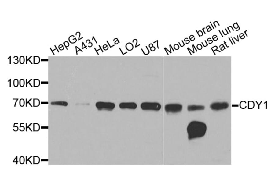 Western Blot - Anti-CDY1 Antibody (A9854) - Antibodies.com