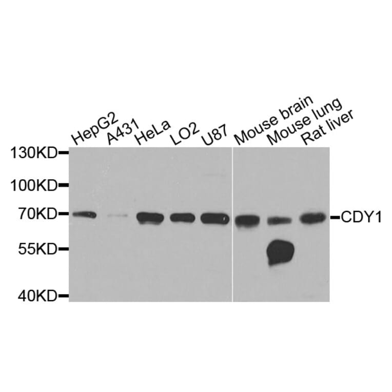 Western Blot - Anti-CDY1 Antibody (A9854) - Antibodies.com