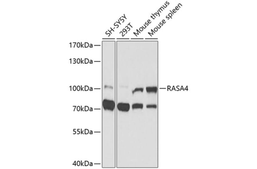 Western Blot - Anti-RASA4 Antibody (A9860) - Antibodies.com