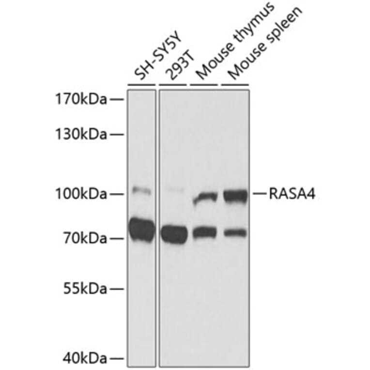 Western Blot - Anti-RASA4 Antibody (A9860) - Antibodies.com