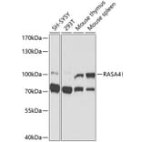 Western Blot - Anti-RASA4 Antibody (A9860) - Antibodies.com