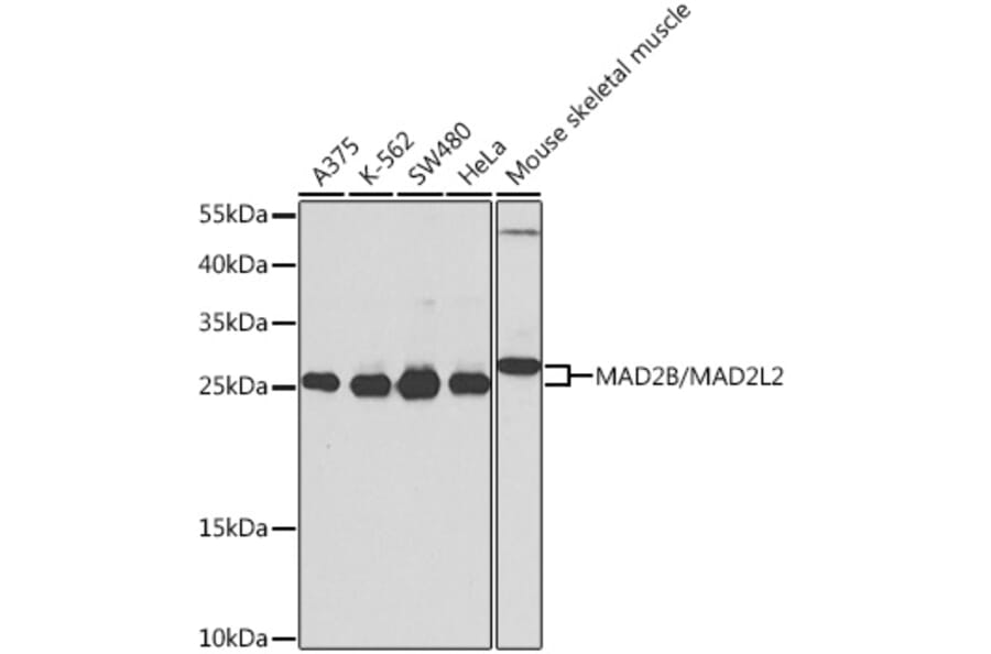 Western Blot - Anti-Mad2L2/REV7 Antibody (A16356) - Antibodies.com
