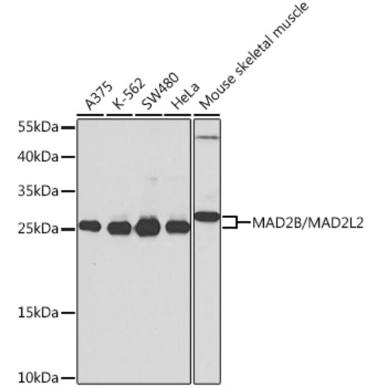 Western Blot - Anti-Mad2L2/REV7 Antibody (A16356) - Antibodies.com