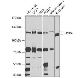 Western Blot - Anti-PLK4 Antibody (A16357) - Antibodies.com