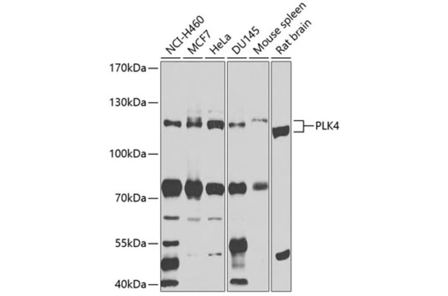 Western Blot - Anti-PLK4 Antibody (A16357) - Antibodies.com