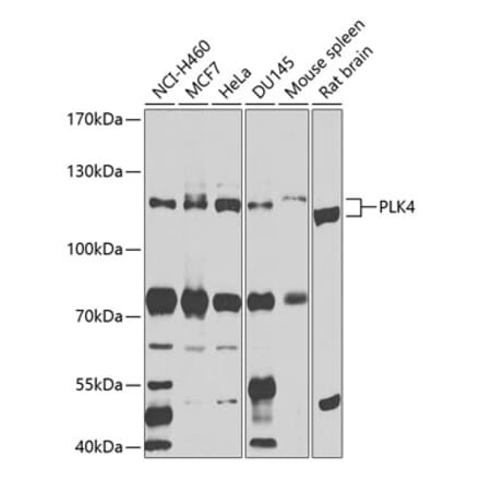 Western Blot - Anti-PLK4 Antibody (A16357) - Antibodies.com