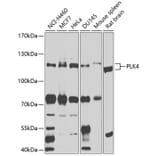 Western Blot - Anti-PLK4 Antibody (A16357) - Antibodies.com