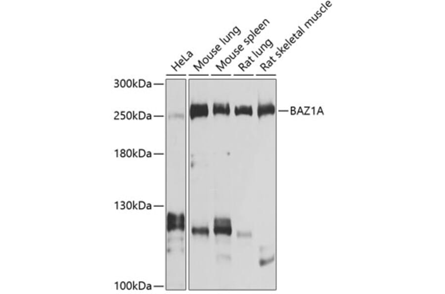 Western Blot - Anti-ACF1/BAZ1A Antibody (A16358) - Antibodies.com